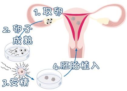 胚胎操作